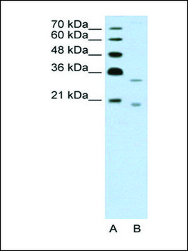 Anti-DNASE2B antibody produced in rabbit IgG fraction of antiserum