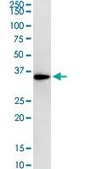 Monoclonal Anti-RPLP0 antibody produced in mouse clone 1B4, purified immunoglobulin, buffered aqueous solution