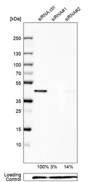 Anti-UBE2Z antibody produced in rabbit Prestige Antibodies&#174; Powered by Atlas Antibodies, affinity isolated antibody, buffered aqueous glycerol solution