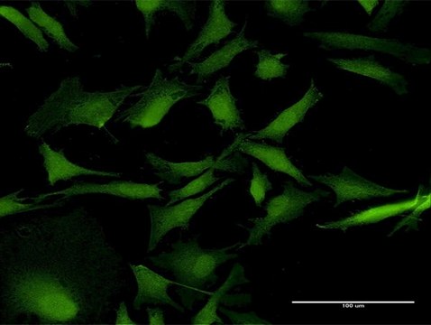 Anti-RAB31 antibody produced in mouse purified immunoglobulin, buffered aqueous solution