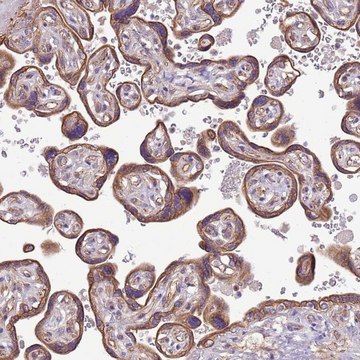 Anti-WASHC4 antibody produced in rabbit Prestige Antibodies&#174; Powered by Atlas Antibodies, affinity isolated antibody, buffered aqueous glycerol solution