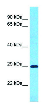 Anti-SLC25A35 antibody produced in rabbit affinity isolated antibody