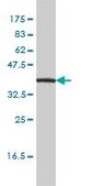 Monoclonal Anti-IL11RA antibody produced in mouse clone 2D4-F4, purified immunoglobulin, buffered aqueous solution