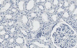 Anti-PHD2/EGLN1 Antibody, clone 1B12 ZooMAb&#174; Rabbit Monoclonal recombinant, expressed in HEK 293 cells