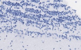 Anti-Doublecortin Antibody, clone 3F11 ZooMAb&#174; Rabbit Monoclonal recombinant, expressed in HEK 293 cells