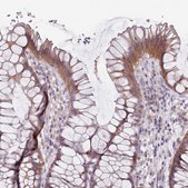 Anti-SLC26A6 antibody produced in rabbit Prestige Antibodies&#174; Powered by Atlas Antibodies, affinity isolated antibody, buffered aqueous glycerol solution