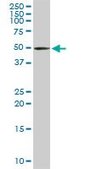 Anti-TRDMT1 antibody produced in rabbit purified immunoglobulin, buffered aqueous solution
