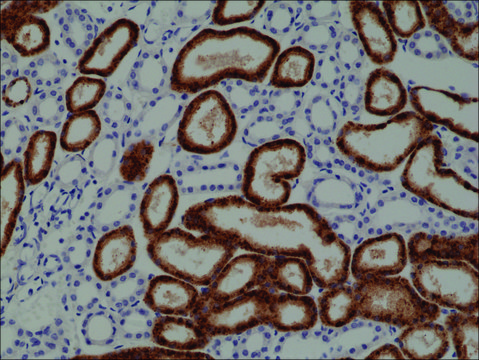 Anti-Napsin-A antibody, Rabbit monoclonal recombinant, expressed in HEK 293 cells, clone RM366, purified immunoglobulin