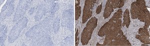 Anti-Integrin &#946;1 Antibody, clone 1A27 , ZooMAb&#174; Rabbit Monoclonal recombinant, expressed in HEK 293 cells