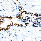 Anti-Progesterone Receptor Antibody, clone 4Y4H5, Rabbit Monoclonal