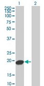 Monoclonal Anti-UBE2C antibody produced in mouse clone 3B1, purified immunoglobulin, buffered aqueous solution