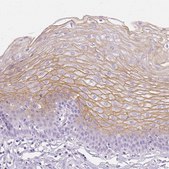 Anti-TGM1 antibody produced in rabbit Prestige Antibodies&#174; Powered by Atlas Antibodies, affinity isolated antibody, buffered aqueous glycerol solution