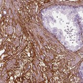 Anti-COL6A2 antibody produced in rabbit Prestige Antibodies&#174; Powered by Atlas Antibodies, affinity isolated antibody