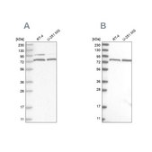 Anti-P2RX7 antibody produced in rabbit Prestige Antibodies&#174; Powered by Atlas Antibodies, affinity isolated antibody, buffered aqueous glycerol solution