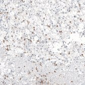 Monoclonal Anti-B3GAT1 antibody produced in mouse Prestige Antibodies&#174; Powered by Atlas Antibodies, clone CL9500, purified immunoglobulin, buffered aqueous glycerol solution