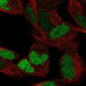 Anti-ESRRG antibody produced in rabbit Prestige Antibodies&#174; Powered by Atlas Antibodies, affinity isolated antibody, buffered aqueous glycerol solution
