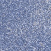 Anti-CHAD antibody produced in rabbit affinity isolated antibody, buffered aqueous glycerol solution
