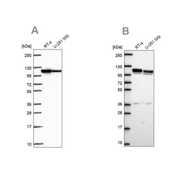 Anti-AP1B1 antibody produced in rabbit Prestige Antibodies&#174; Powered by Atlas Antibodies, affinity isolated antibody