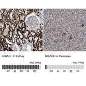 Anti-HIBADH antibody produced in rabbit Prestige Antibodies&#174; Powered by Atlas Antibodies, affinity isolated antibody, buffered aqueous glycerol solution, Ab1