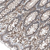 Anti-GADD45G antibody produced in rabbit Prestige Antibodies&#174; Powered by Atlas Antibodies, affinity isolated antibody, buffered aqueous glycerol solution