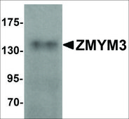 Anti-ZMYM3 antibody produced in rabbit affinity isolated antibody, buffered aqueous solution