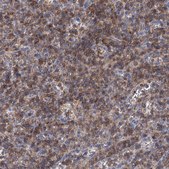 Anti-LRCH4 antibody produced in rabbit Prestige Antibodies&#174; Powered by Atlas Antibodies, affinity isolated antibody, buffered aqueous glycerol solution