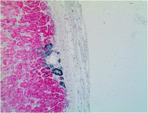 Anti-CYP11B2 Antibody, clone 41-17B clone 41-17B, from mouse