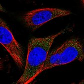 Anti-MARCH3 antibody produced in rabbit Prestige Antibodies&#174; Powered by Atlas Antibodies, affinity isolated antibody, buffered aqueous glycerol solution