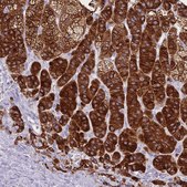 Anti-CYP21A2 antibody produced in rabbit Prestige Antibodies&#174; Powered by Atlas Antibodies, affinity isolated antibody, buffered aqueous glycerol solution