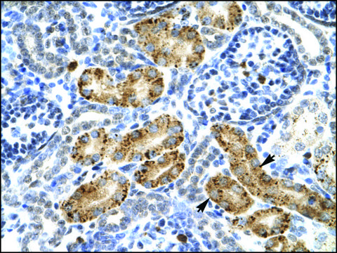 Anti-P2RX2 (AB1) antibody produced in rabbit IgG fraction of antiserum