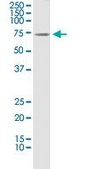 Monoclonal Anti-CLU antibody produced in mouse clone 1A11, purified immunoglobulin, buffered aqueous solution