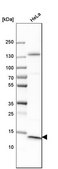 Anti-CT83 antibody produced in rabbit Prestige Antibodies&#174; Powered by Atlas Antibodies, affinity isolated antibody, buffered aqueous glycerol solution