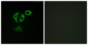 Anti-TACC3 antibody produced in rabbit affinity isolated antibody