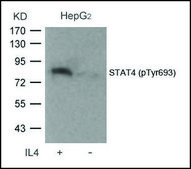Anti-phospho-STAT4 (pTyr693) antibody produced in rabbit affinity isolated antibody
