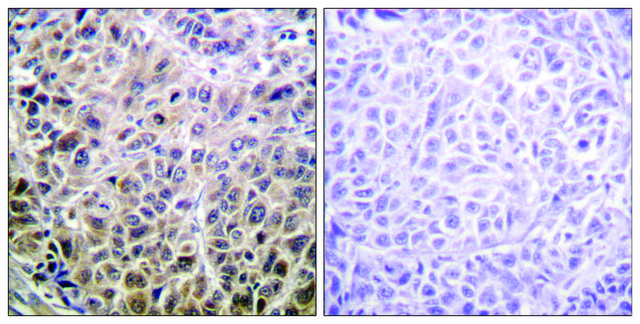 Anti-DAPK1 antibody produced in rabbit affinity isolated antibody