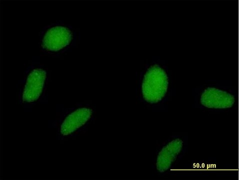 Anti-SPOP antibody produced in mouse purified immunoglobulin, buffered aqueous solution