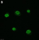 Anti-SLFN11 Antibody, clone 3E13 ZooMAb&#174; Rabbit Monoclonal recombinant, expressed in HEK 293 cells
