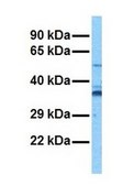 Anti-ART4 antibody produced in rabbit affinity isolated antibody
