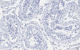 Anti-MGMT Antibody, clone 2N19 ZooMAb&#174; Rabbit Monoclonal recombinant, expressed in HEK 293 cells