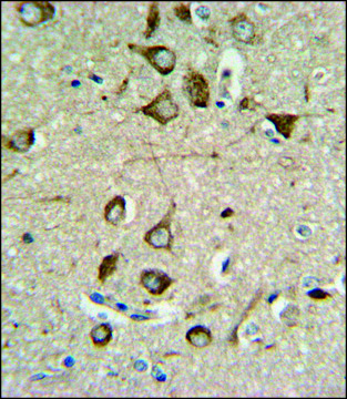 ANTI-ASMT (CENTER) antibody produced in rabbit IgG fraction of antiserum, buffered aqueous solution