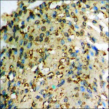 Anti-phospho-ICK (pTyr159) antibody produced in rabbit affinity isolated antibody