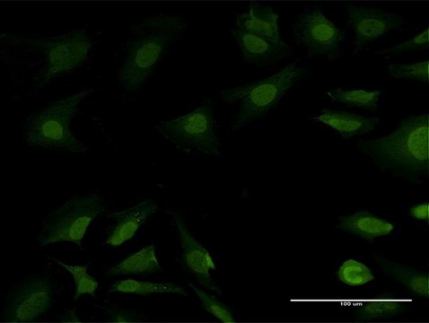 Anti-PSMB7 antibody produced in mouse purified immunoglobulin, buffered aqueous solution