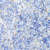 Anti-GSK3B antibody produced in rabbit