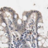 Anti-PROS1 antibody produced in rabbit Prestige Antibodies&#174; Powered by Atlas Antibodies, affinity isolated antibody, buffered aqueous glycerol solution
