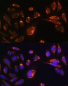 Anti-CHCHD2 antibody produced in rabbit