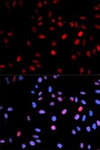 Anti-Phospho-p53-S15 antibody produced in rabbit