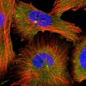 Anti-MDH1 antibody produced in rabbit affinity isolated antibody, buffered aqueous glycerol solution, ab1