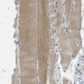 Anti-MAGI2 antibody produced in rabbit Prestige Antibodies&#174; Powered by Atlas Antibodies, affinity isolated antibody, buffered aqueous glycerol solution