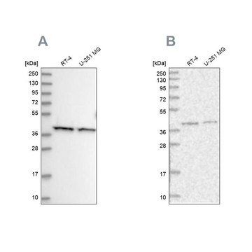 Anti-PSMD13 antibody produced in rabbit Prestige Antibodies&#174; Powered by Atlas Antibodies, affinity isolated antibody, buffered aqueous glycerol solution