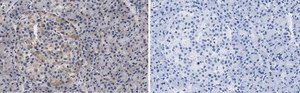 Anti-Helicase MOV-10 Antibody, clone 3B8 ZooMAb&#174; Rabbit Monoclonal recombinant, expressed in HEK 293 cells